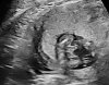 16wk_8.jpg