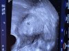 20231016_083759.jpg