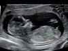 13 weeks (3).jpg