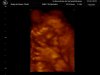 BABY_31_zpsd85ac92b.jpg