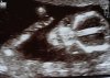 foto 1-1.jpg