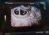 Echo 5-8-2013.jpg