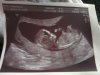 baby echo.jpg