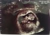 Echo 10.4 week.jpg