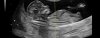 IMG_0417.jpeg