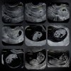 echo-baby-eerste-12-weken-overzicht.jpg