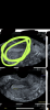 965A9D7B-4A5C-4C04-8ED5-A7A9EF9023E0.png