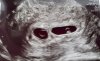 20231228_120936.jpg