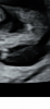 572A0195-8E5A-4389-936A-7E902E4254AD.png