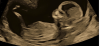 B799BCA2-C0C4-44F4-A31E-D0A6E2C6EC16.png