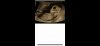 464839B7-AA5C-40E5-BE8D-105ACE411AE3.png
