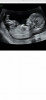 8EDC47F8-C338-46DF-BC93-B5D60991B91C.png