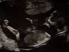 IMG_7625.jpeg