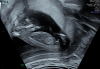 upload_2024-3-7_22-59-28.png