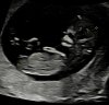 Screenshot_20240313_201957_Gallery.jpg