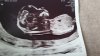 IMG-20240320-WA0002.jpeg
