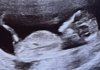 IMG_1843.jpeg