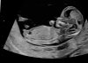 IMG_4269.jpeg