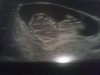 74586-albums13388-picture82951.jpg