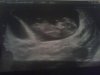 74586-albums13388-picture82952.jpg