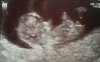 baby2.jpg