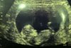 Baby 12+2.jpg