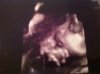 25w5d.jpg