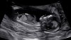 336242d9-ad07-4010-98a8-4c3192bc5b6d.jpeg