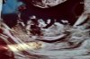IMG-20240809-WA0013.jpeg