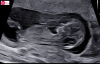 upload_2024-10-3_15-10-49.png