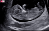 upload_2024-10-3_15-11-28.png
