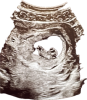 upload_2024-10-4_6-27-19.png