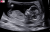 upload_2024-10-16_16-8-55.png
