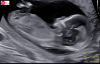 upload_2024-10-16_16-9-35.png