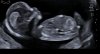 Screenshot_20241112_185909_Gallery.jpg