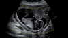 vlcsnap-2024-12-17-13h24m10s172ingezoomd.png