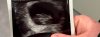 IMG_9194.jpeg