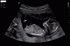 20250104_141027.gif