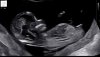 09d07cd5-8f41-4c71-894b-f877141ef833.jpeg
