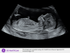 #Ultrasound_6.png