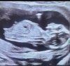 IMG_0955.jpeg