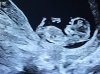 20250408_085711.jpg