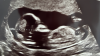 Scherm­afbeelding 2025-05-20 om 11.51.11.png