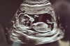 Scherm­afbeelding 2025-05-20 om 11.05.22.png
