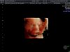 BABY HARTMAN_9.jpg