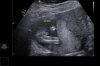 ECHOWONDER_0006.jpg