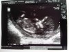 IMG00219-20120619-1711.jpg