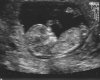echo 12 wk1dg.jpg