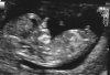 echo 12 wk1dg-1.jpg