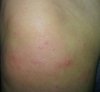 knie.jpg